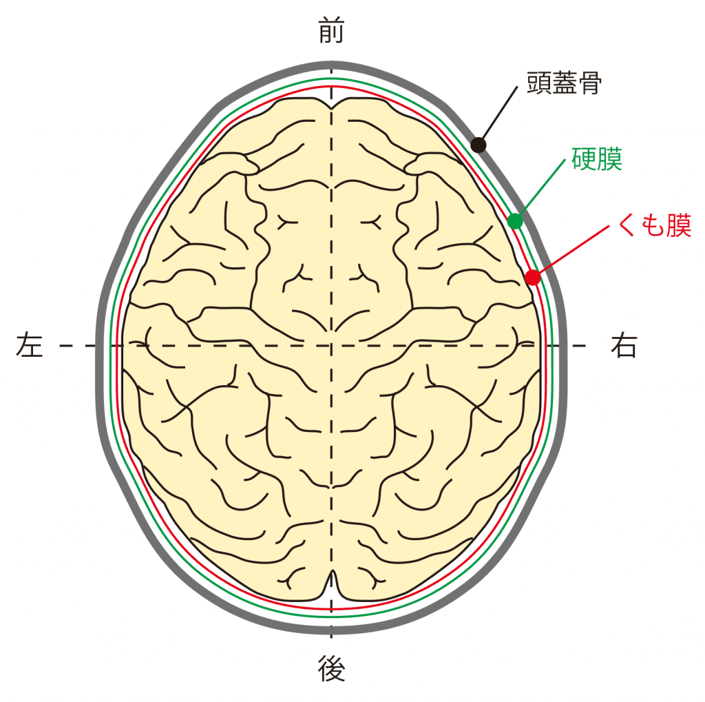 脳挫傷